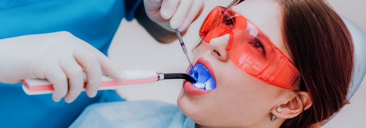 image showing dental sealant being applied